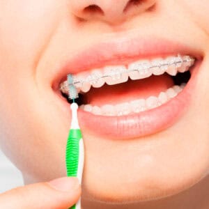 Higiene en la ortodoncia