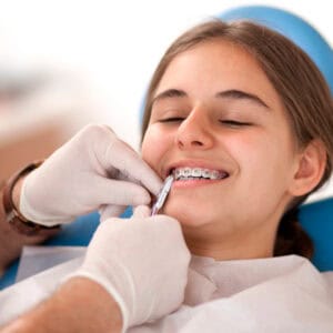 controles de ortodoncia