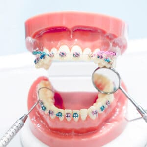 tratamiento de brackets