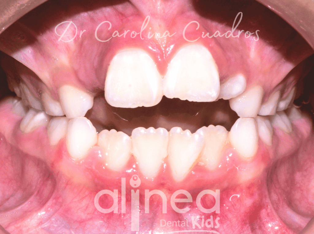 Dentista para niños