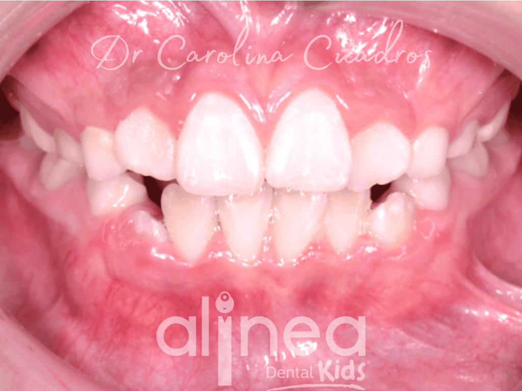 Dentista para niños