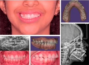 Estudio-de-Ortodoncia-Dra-Gabriela-Cuadros lima peru