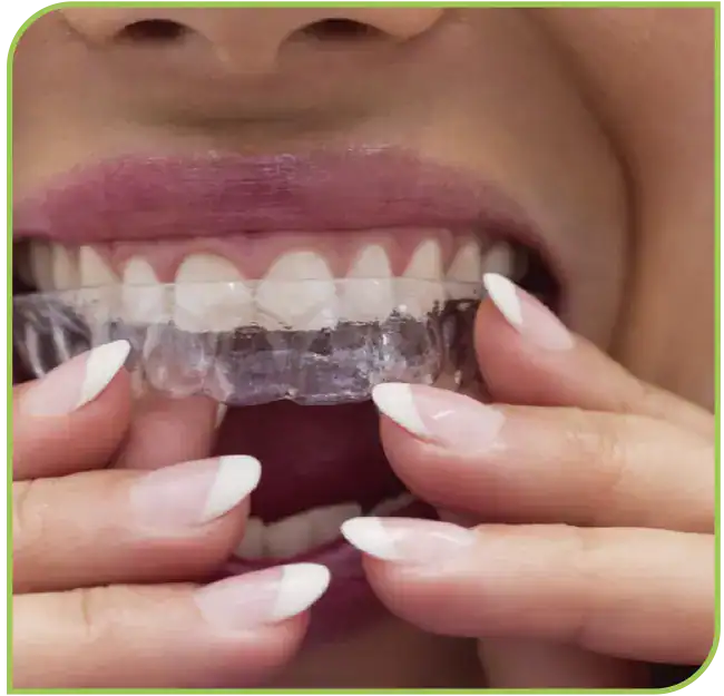 Invisalign alineadores invisibles ortodoncia sin brackets ALINEA LIMA PERU