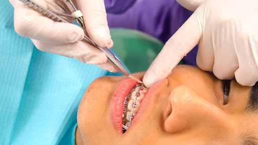 como elegir un ortodoncistas de confianza