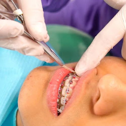 como elegir un ortodoncistas de confianza