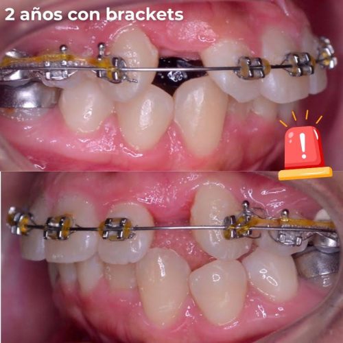 como saber si proceso de ortodoncia va mal